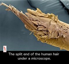 Photo Hair Under Microscope, Hair Science, Natural Hair Transitioning, Salon Pictures, Under A Microscope, Transitioning Hairstyles, Split Hair, Things Under A Microscope, Hair Product