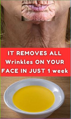 IT REMOVES ALL Wrinkles ON YOUR FACE IN JUST 1 week\n#WrinkleFreeLiving\n#RadiantBeauty\n#ForeverFlawless\n#GlowingYouth\n#YouthfulSkinGoals Wrinkle Remedies Face, Face Wrinkles Remover, Eyelid Wrinkles, Natural Wrinkle Remedies, Face Wrinkles Remedies, Wrinkle Prevention, Wrinkles Remedies, Home Remedies For Wrinkles