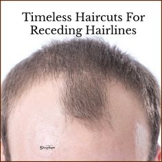 Types Of Buzzcuts Men Haircuts, Short Hair Men Receding Hairline, Men Haircuts With Beards, Mens Hairstyles Receding Hairline Thinning Hair Men Haircuts, Buzz Cut For Receding Hairline, Receding Hair Styles For Men, Classic Male Haircut, Best Haircut For Receding Hairline Men, Hair Cuts For Receding Hairline Men