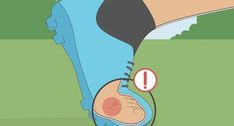 10 Ways to Get Rid of Shin Splints - wikiHow Scar Tissue Massage, Ankle Fracture, Ways To Exercise, Lower Leg Muscles, Hypertrophic Scars, Johns Hopkins Hospital, Body Alignment, Broken Foot, Venous Insufficiency