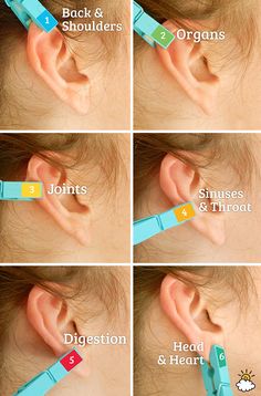 Experience incredible pain relief method simply by putting a clothespin on your ear. Ear Reflexology, Reflexology, Health Info, Acupressure, Health And Beauty Tips, Natural Medicine, Alternative Medicine, Massage Therapy, Acupuncture