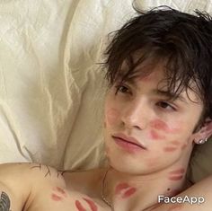 a shirtless young man laying in bed with red spots on his face and chest