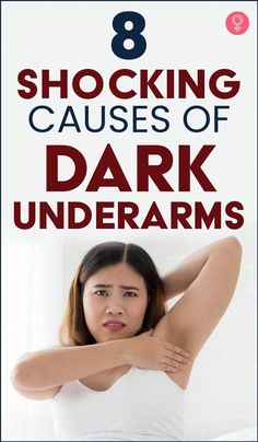 How many times have you stood in front of the wardrobe, picked that tank top up, and threw it back in? You know you can’t wear it because of your dark armpits. Removing Dark Armpits, Unwanted Hair Permanently, Remove Unwanted Facial Hair, Dark Armpits, Unwanted Hair Growth, Armpit Fat, Dark Underarms, Regrow Hair