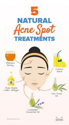 There’s nothing more aggravating than waking up to a volcano-sized zit. Use these natural remedies as an emergency acne spot solution. Acne Scar Diy, Bad Acne, Natural Acne Remedies, Natural Acne, Types Of Acne, Acne Scar Removal, Baking Soda Shampoo, Acne Spots, Cystic Acne