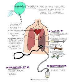 the diagram shows how to use an inhaler for breathing and other medical devices