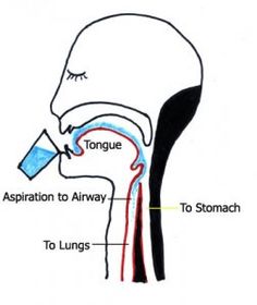 Dysphagia Therapy, Feeding Therapy, Drain Cleaners, Slp Activities, Oral Motor, Slp Resources, Speech Path, Speech Therapy Materials, Speech Therapy Resources