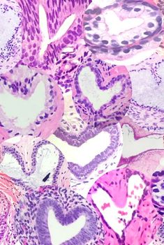 an animal's heart shaped pattern is shown in pink and purple