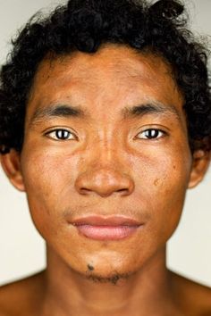 a man with freckles on his face looking at the camera