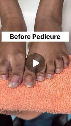 Pihu officials on Instagram: "Get Fair Feet & Hand Permanently | Get Rid of Dark Feet, Easy Pedicure & Manicure   . . . . #darkfeet #dirtyfeet #ridofdarkfeet #manicure #pedicure #permanentfairhand #permanentfairfeet #skincareblogger #trendingreels #instagood #instagram #viral" Foot Soak Listerine, Pedicure Advertising Ideas, Pedicure Ideas Brown, Pedicure Autumn, Feet Gel Polish, Ingrowing Toenail, Corn Removal On Toes, Feet Manicure, Beautiful Foot Nails