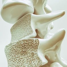 Osteoporosis Symptoms, Bone Density Test, Hip Fracture, Sistem Pencernaan, Bone Fracture, Bone Diseases, Bone Strength