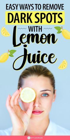 How To Use Lemon To Lighten Skin, How To Treat Dark Spots On Face, How To Remove Spots On Face, Natural Remedy For Hyperpigmentation, How To Remove Sun Spots On Face, Dark Spots On Legs Remove Diy, Vitamin C For Dark Spots, Lemon Skin Uses