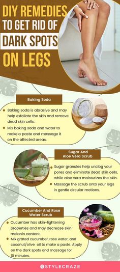 Do you have dark spots on your legs? Read this article to know what causes brown spots on legs and how to remove them and get smooth and clear skin. Dark Spots On Legs, Spots On Legs, Strawberry Legs, Dark Spots On Skin, Spots On Face, Diy Remedies, Remove Dark Spots, Unwanted Hair Removal, Skin Care Recipes