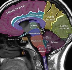 an mri scan shows the location of the cerebratorys in the brain