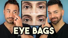 How Treat Under Eye Bags Like A Dermatologist Under Eye Bags Remedies, Esthetics Business, Chronic Dry Eye, Bags Under Eyes, Face Transformation, Caster Oil, Dry Skin Remedies, Fine Wrinkles, Paula's Choice