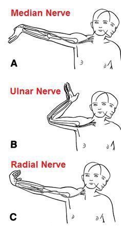 Punkty Spustowe, Ulnar Nerve, Median Nerve, Acupressure Mat, Muscle Anatomy, Yoga Iyengar, Hand Therapy, Medical Anatomy, Optimal Health