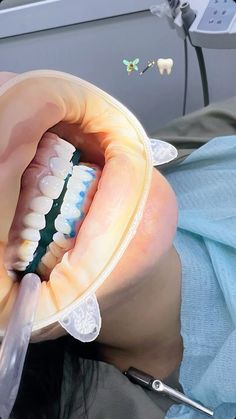 Female Dentist Aesthetic, Orthodontist Aesthetic, Orthodontist Assistant, Dentist Career, Dentist Social Media, Dental Aesthetic, Future Dentist