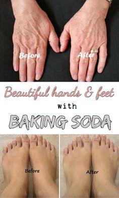 Baking Soda Scrub, Baking Soda For Hair, Baking Soda Water, Face Scrub Homemade, Baking Soda Uses, Baking Soda Shampoo