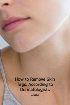 Wondering how to remove skin tags? We talked to board-certified dermatologists about what exactly skin tags age, the right way to approach removal, which at-home remedies (if any) are safe and effective, and how to prevent them in the future. Remove Skin Tags