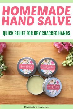 Dry Hands Remedy Diy, Diy Hand Moisturizer, Cracked Hands Remedy, Diy Hand Lotion, Hand Lotion Recipe, Diy Balm, Dry Hands Remedy, Diy Salve, Hand Cream Recipe