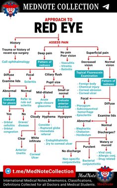 Ophthalmic Technician, Eye Health Facts, Eye Medicine, Medical Mnemonics, Nursing School Essential