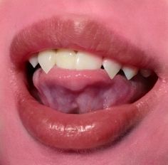 a close up view of a person's mouth with teeth and gums on it