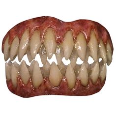 an open mouth with teeth and gums on it