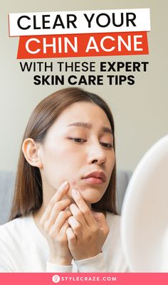 Acne or acne vulgaris affects around 50 million Americans annually, and 85% of them (between the ages of 12 and 24) develop minor acne. Though you can break out on any part of your face, chin acne and breakouts along the jawline are common. And it is associated with your hormone levels .