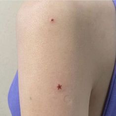 a woman's arm with small red dots on her left arm and the other half of her arm