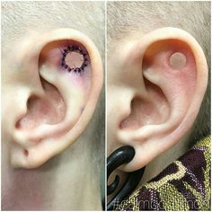 two pictures of an ear with a hole in the middle and one has a circle on it