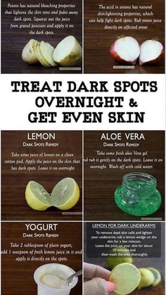 Dark Spots Remedies, Fresh Aloe Vera Gel, Black Heads, Brown Spots Removal, Resep Diet, Skin Spots, Beauty Tips For Glowing Skin, Baking Soda Shampoo, Beauty Remedies