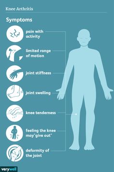 Knee Arthritis: Symptoms, Causes, Diagnosis, Treatment Broken Elbow, Nerve Health, Restless Leg Syndrome, Nerve Pain Relief, Sciatic Nerve Pain, Sciatic Nerve, Knee Pain, Physical Therapy