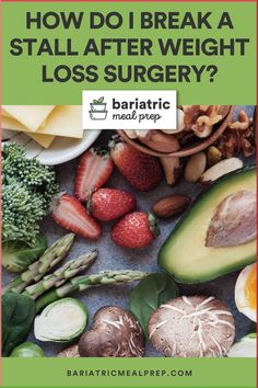 If you're experiencing a weight loss stall after bariatric surgery, don't worry! This is common and there are ways to break through it. Here are some tips that can help get your weight loss journey back on track. Bariatric Meal Prep, Bariatric Sleeve, Bariatric Friendly Recipes, Bariatric Diet, Sleeve Surgery, Bariatric Recipes, Common Questions, Back On Track