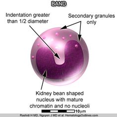 an image of a purple ball with words describing the different areas in which it is located