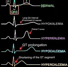 Nursing Student Tips, Medical Student Study, Best Nursing Schools, Nursing School Studying, Medical School Inspiration, Nursing School Tips, Medical School Studying