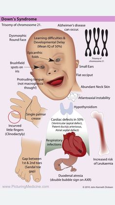 the anatomy of an infant's head and neck