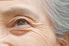 Wrinkles aren’t the only thing making your skin look old. The latest ways to protect and improve thinning skin from a Harvard dermatologist… Top Treatments, Eye Wrinkle, Wrinkled Skin, Look Older, Healthy Aging, Wrinkle Remover, Damaged Skin, Skincare Routine, Anti Aging