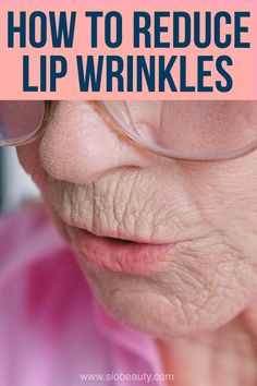 Wrinkles Remedies Face, Mouth Wrinkles, Acne Prone Skin Care, Wrinkle Remedies, Tips For Oily Skin, Face Tips, Lip Wrinkles, Face Creams