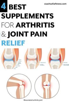 4 Important Arthritis & Joint pain Supplements For Relief Thumb Pain Relief, Joints Pain Remedy, Pain Relief Remedies, Knee Pain Relief, Joints Pain Relief, Healthy Joints, Natural Pain Relief, Better Posture, Best Supplements