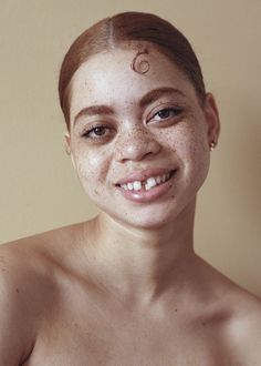 a woman with freckles on her face smiles at the camera while wearing a bra