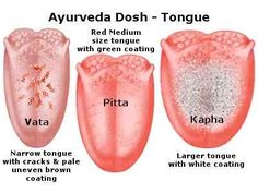 Ayurveda Pitta, Ayurveda Kapha, Ayurveda Dosha, Ayurveda Massage, Ayurveda Vata, Ayurveda Diet, Ayurvedic Therapy, Ayurvedic Diet, Ayurveda Life