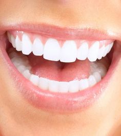 15 Serious Side Effects Of Oil Pulling Teeth Whitening Homemade, Coconut Oil For Teeth, Kedokteran Gigi, Straight Teeth, Sikat Gigi