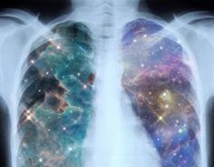 the lungs are made up of many different colors and sizes, with stars all over them