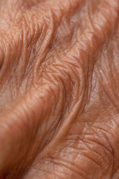 closeup of the skin of an older person's hand