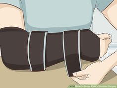 4 Ways to Dress After a Shoulder Surgery - wikiHow Surgery Day Outfit, Cubital Tunnel Syndrome, Rotator Cuff Tear