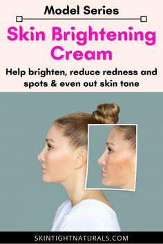 You will love our skin brightening cream. This superb formula was designed to help even out skin tone without harsh bleaching. It is designed to improve overall color balance, radiance and prevent further skin damage. How great will it be to have beautiful skin without wearing tons of makeup to hide imperfections? You deserve it! We can feel your feelings. Click to brighten your skin from today #skinbrightening #skinbrighteningcream #skinlighteningcream #skilightening #skincare Feel Your Feelings, Acne Hyperpigmentation, Celebrity Skin, Professional Skin Care Products, Brightening Cream, Acne Blemishes