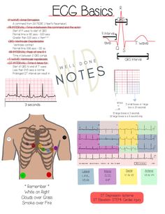 2 Guides: ACLS Study Guide and EKG Basics. These guides go great together when studying cardiac rhythms or preparing for ACLS. I made these for myself and they helped so much. Ekg Electrode Placement, 12 Lead Ekg Interpretation Made Easy, Ekg Study Guide, Ekg Technician Aesthetic, Ekg Notes, Ekg Basics, Acls Study Guide, Ekg Technician, Ekg Rhythms