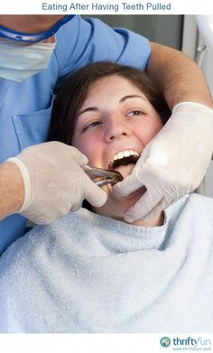 Following your dentists instructions is important after a tooth extraction. Make sure you eat foods that will aid in healing. This is a guide about eating after having teeth pulled. Eating After Tooth Extraction, Food After Tooth Extraction, Soft Foods To Eat, Tooth Extraction Aftercare, Tooth Extraction Healing, Snap On Smile, Tooth Pulled, Bad Teeth, Dental Tourism