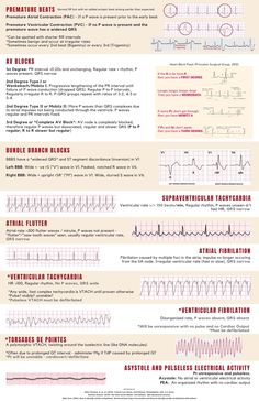 Cardiac Monitor Tech, Cath Lab Technician, Paramedic Cardiology, Cath Lab Nursing, Ekg Interpretation, Nurse Teaching, Medical Assistant Student