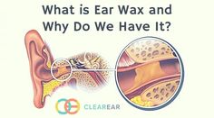 what is ear wax and why do we have it Ear Wax Buildup, Sagging Neck