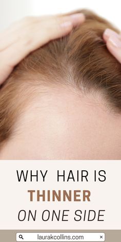 Learn why your hair is thinner on one side than the other! This is actually very common and has a simple at home solution! I'll also discuss what you can do for thinning hair, as well as the best ways to thicken thin hair. Thinning Hair, What You Can Do, One Sided, The Other Side, Fix It, The 4, You Can Do, Siding